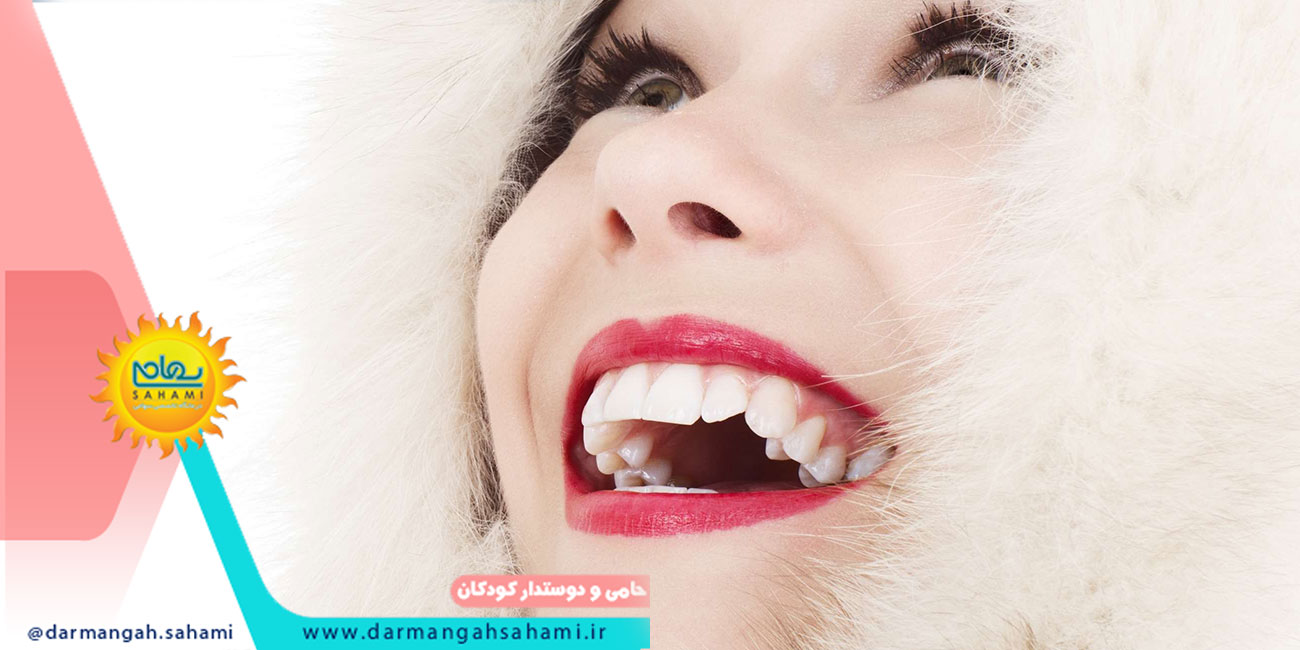لمینت دندان در شیراز