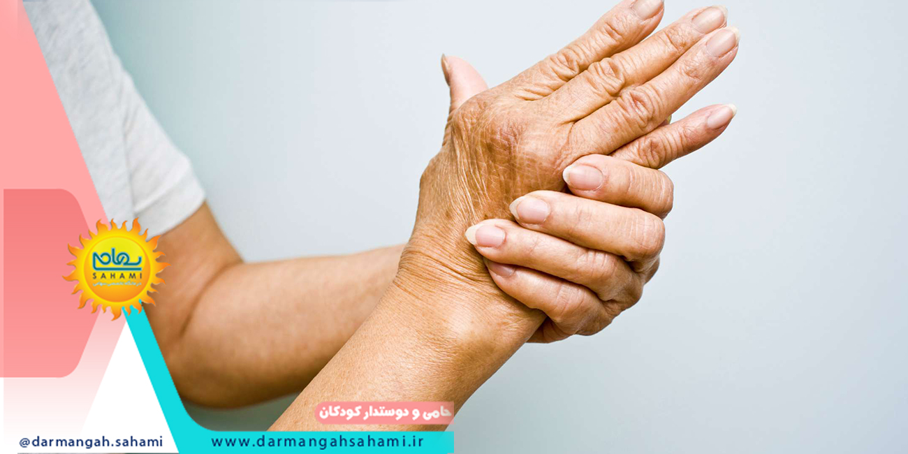 درمان آرتروز 