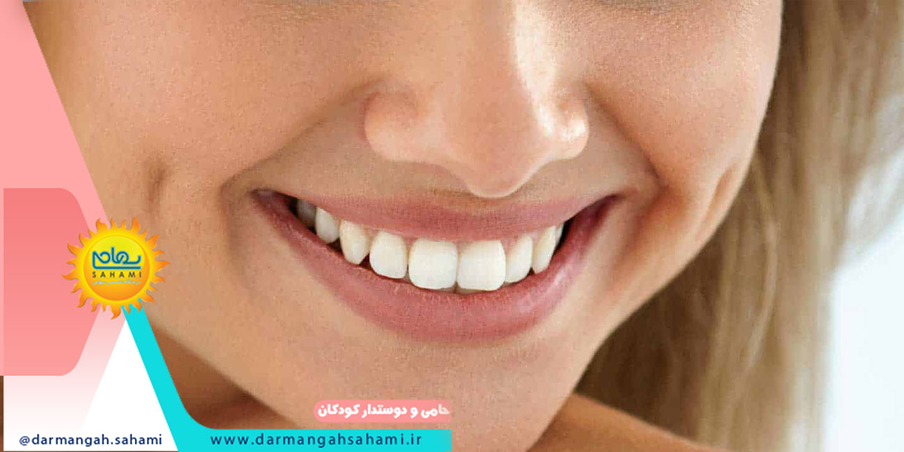 چگونه دندان های زرد خود را سفید کنیم؟