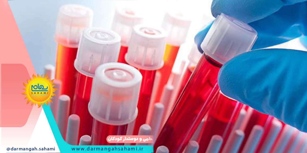 خون گیری در شیراز