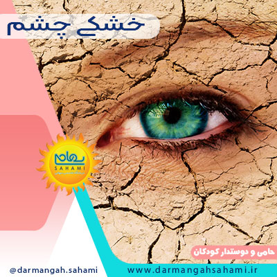 خشکی چشم