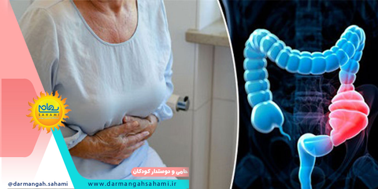 رفع یبوست با مواد غذایی 