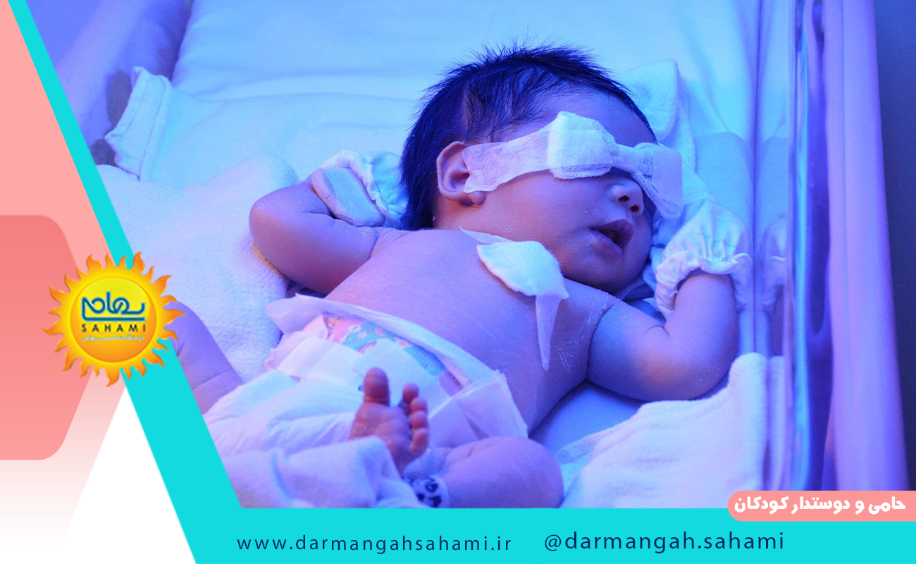 آزمایش مناسب برای زردی کودکان