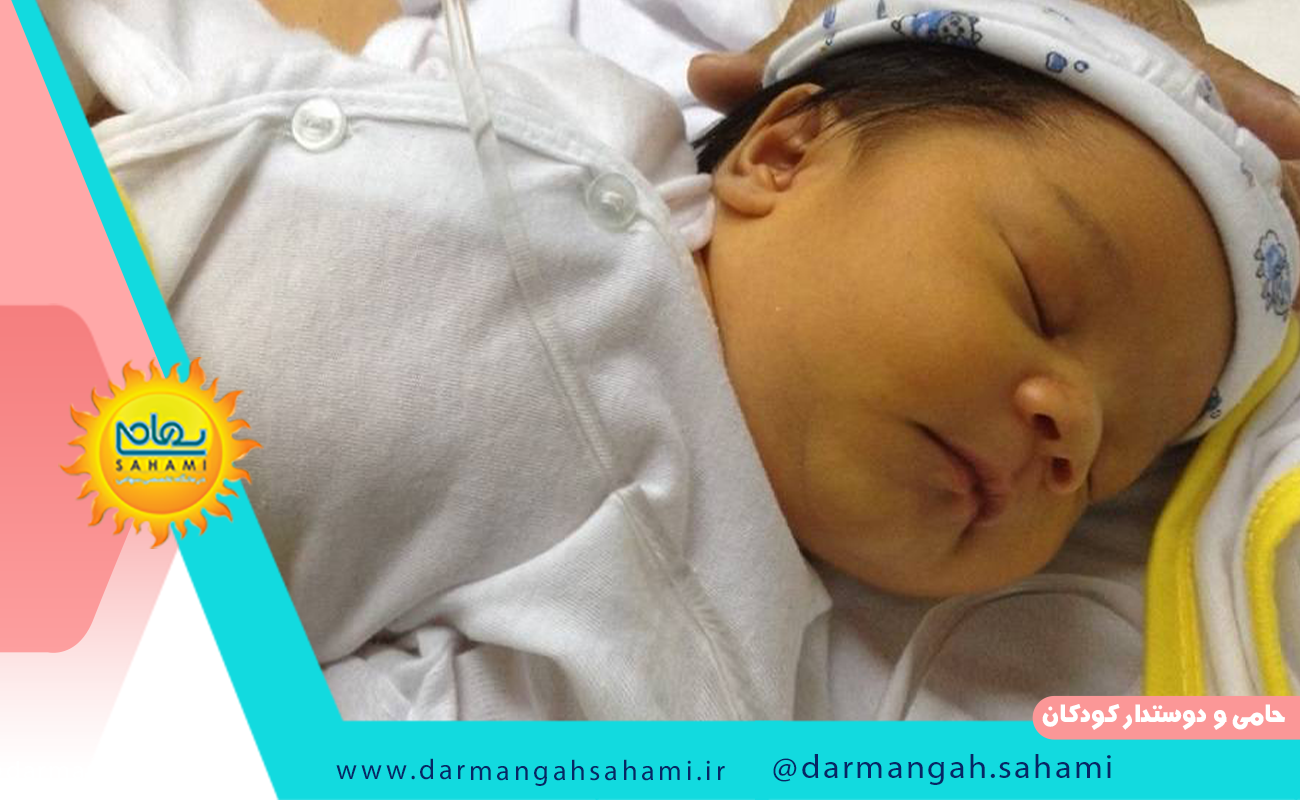 خطرات عدم درمان بیلی روبین