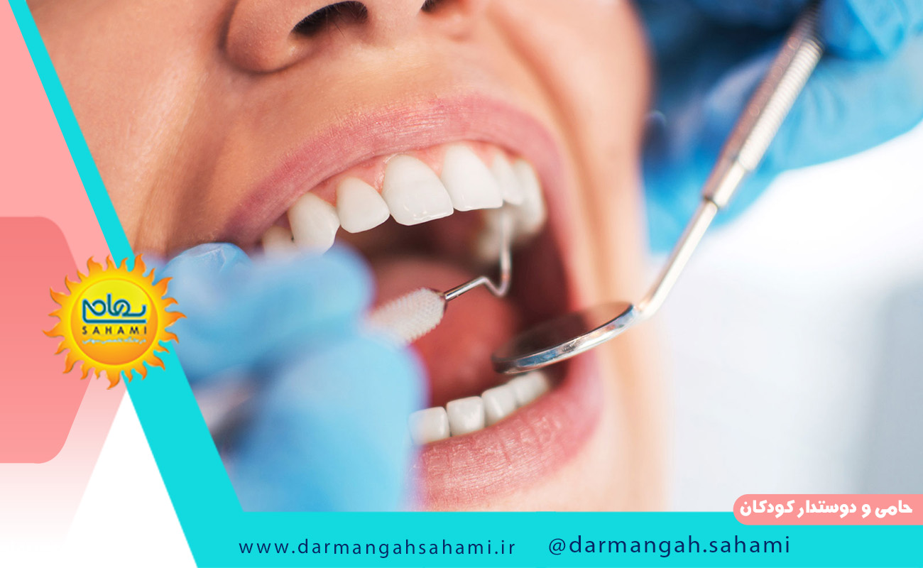 هر آنچه که باید در مورد فیسینگ دندان بدانید