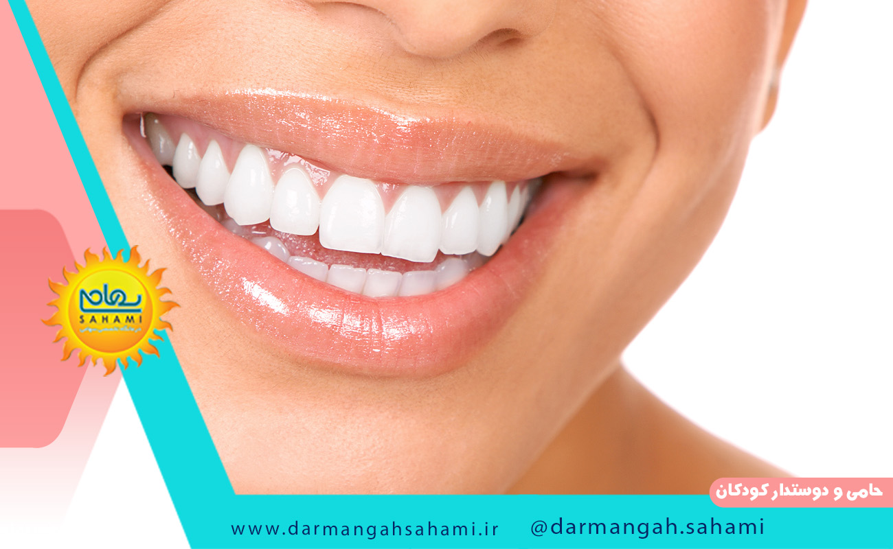 کاربرد فسینگ دندان