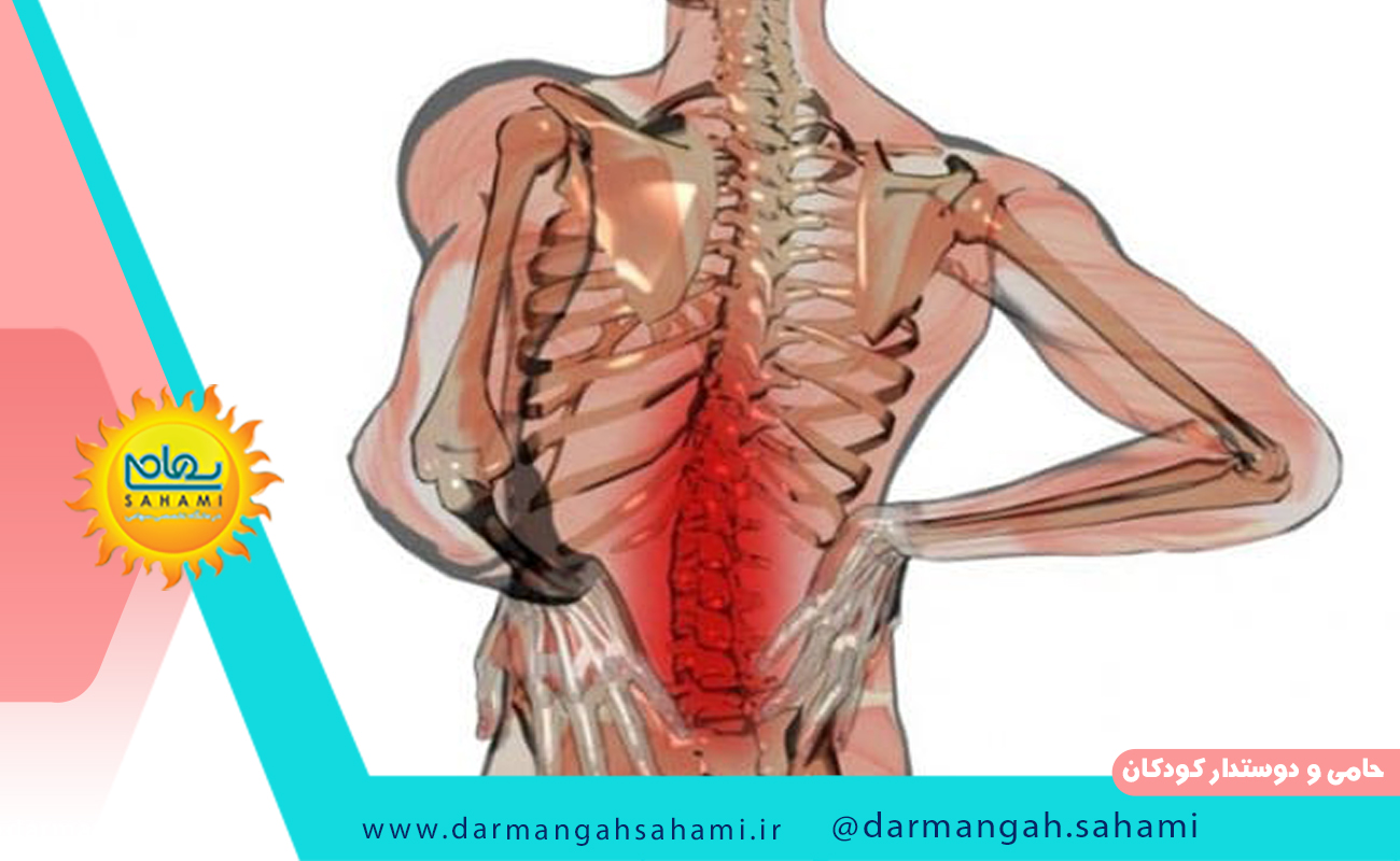 دیسک کمر در چه زمانی رخ می دهد؟