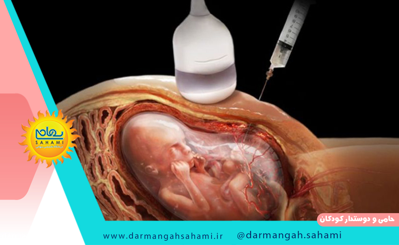 غربالگری بارداری